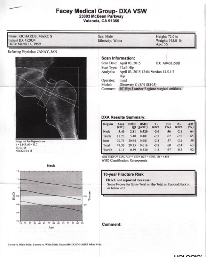 Bone Density 3-2015